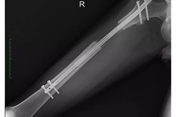 34325-0014-65652-1-67af38590fa90